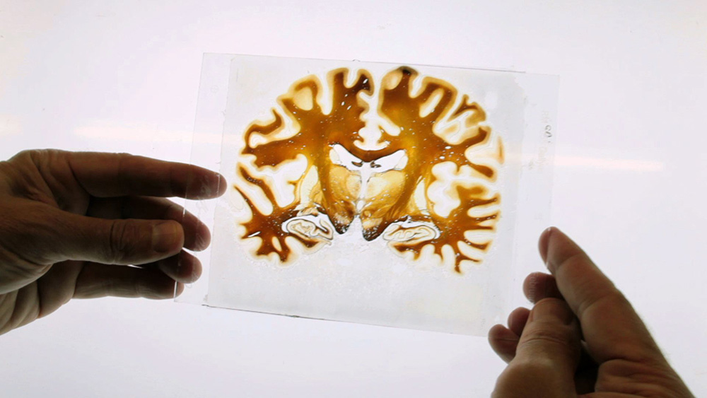 brain brain